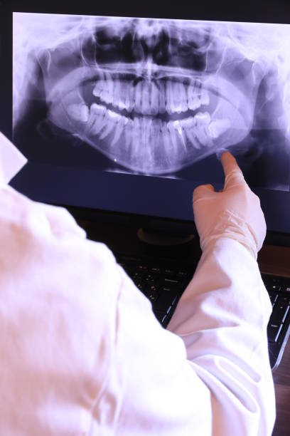 Best Emergency Dentist for Lost Fillings or Crowns in Bean Station, TN